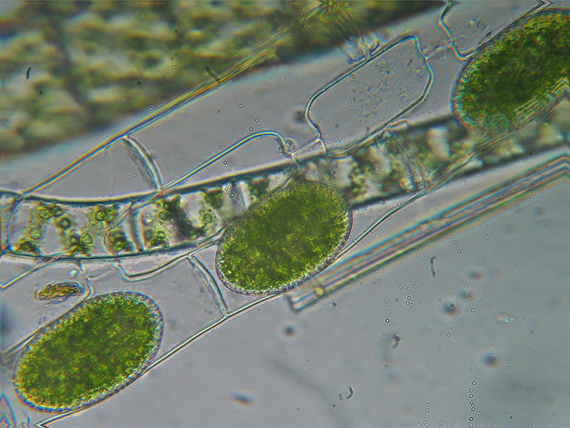 Coniugazione di Spirogyra